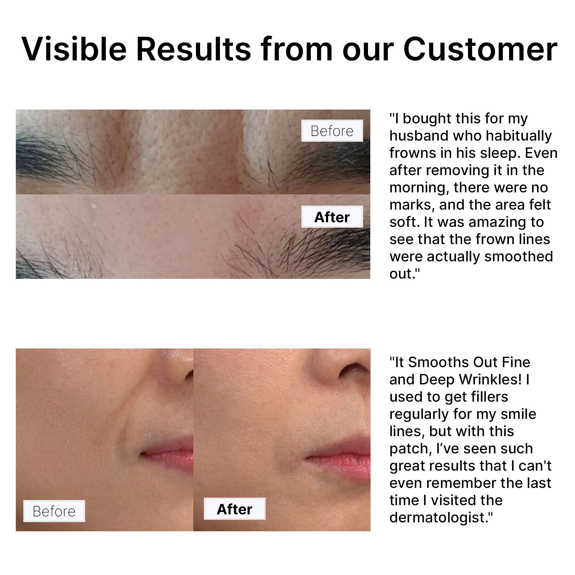 Hue Calm Anti-Wrinkle Patches – Heart-Shaped Vegan Lifting Patches